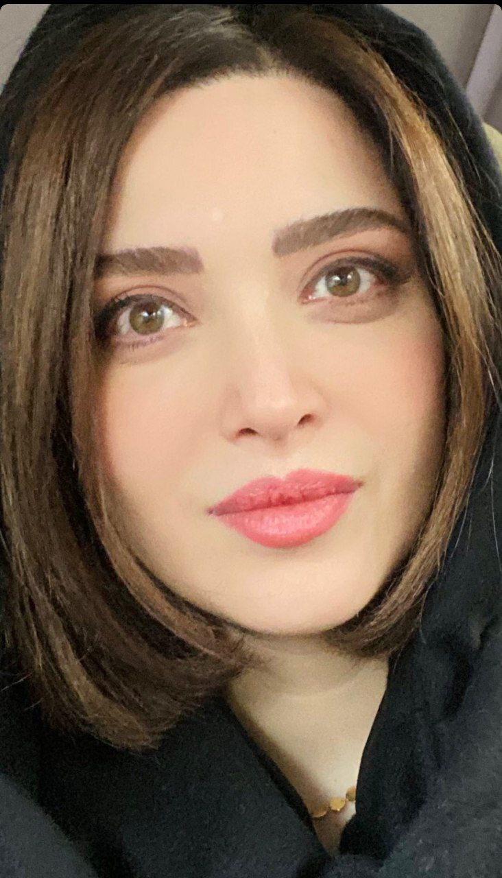 تغییر مجدد چهره بهنوش طباطبایی/ عکس تغییر مجدد چهره بهنوش طباطبایی/ عکس