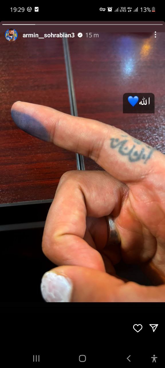 لاک دست بازیکن استقلال هنگام تمدید سوژه شد!