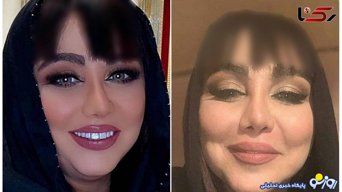 کتک کاری بهنوش بختیاری با همسرش / نمیخواهم طلاق بگیرم ! + فیلم