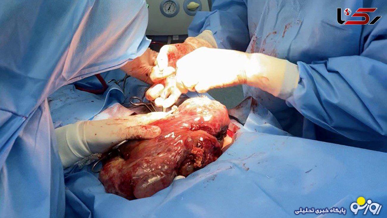 راز شکم برآمده دختر 12 ساله کرمانشاهی چه بود؟ / همه شوکه شدند + عکس راز شکم برآمده دختر 12 ساله کرمانشاهی چه بود؟ / همه شوکه شدند + عکس